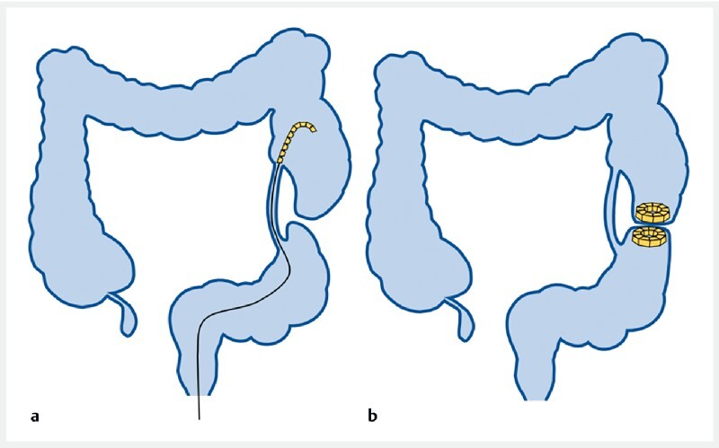 Fig. 2