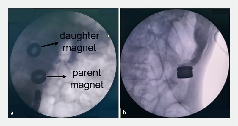 Fig. 3