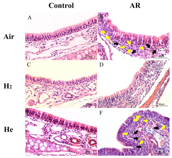 Exp Ther Med. 2018 Oct 19;16(6):5178–5184. doi: 10.3892/etm.2018.6880