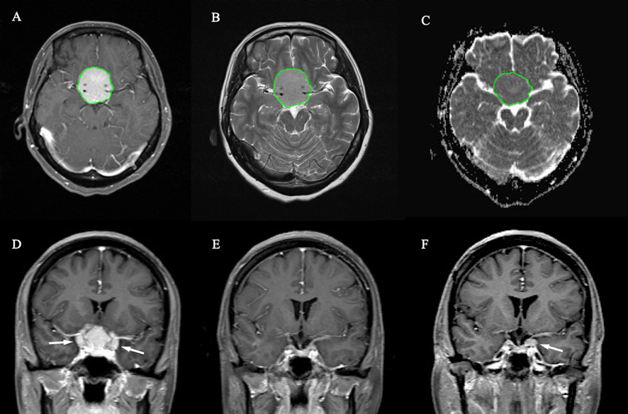 Figure 2.