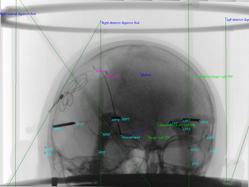 Figure 9