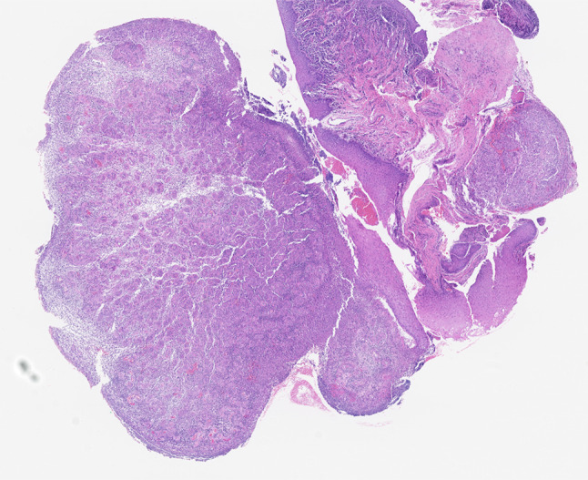 Fig. 2
