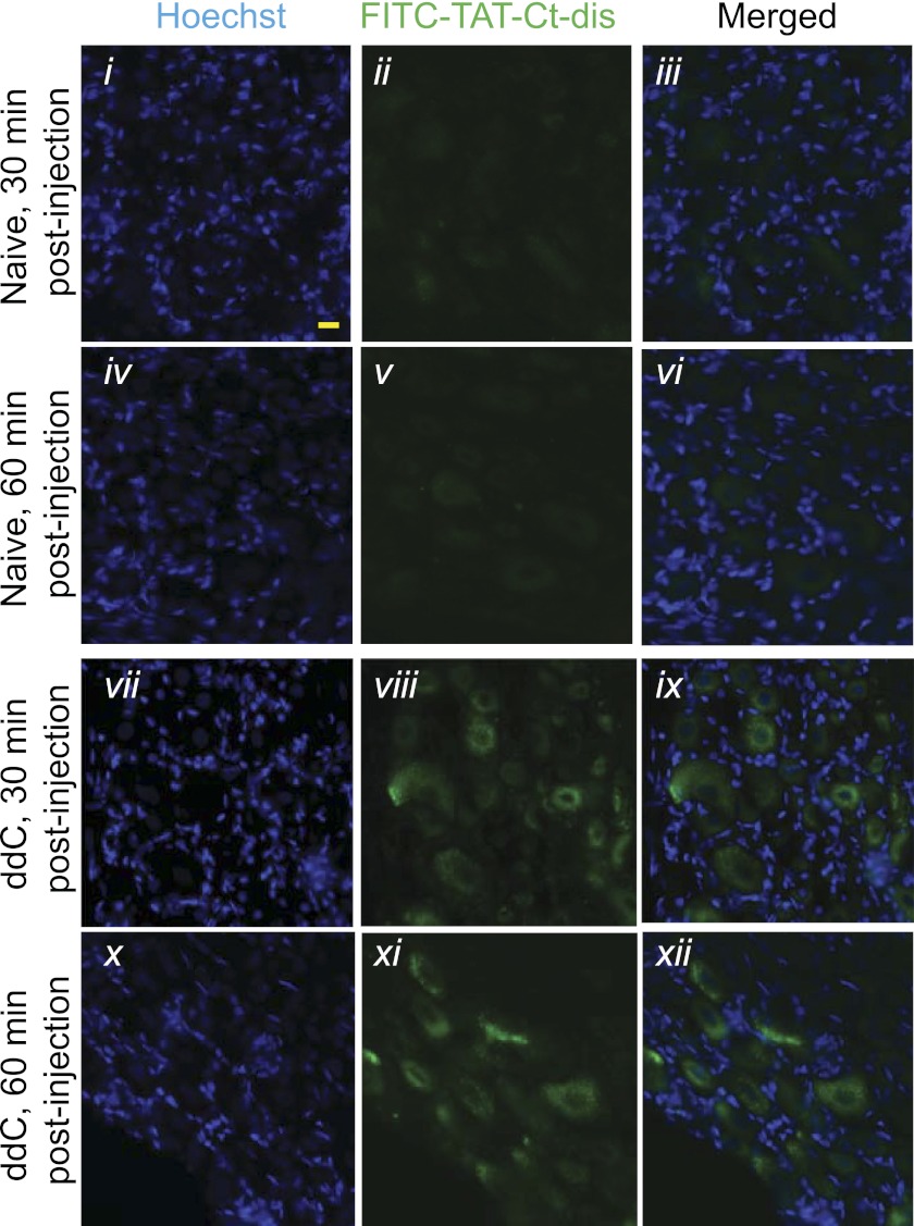 FIGURE 11.