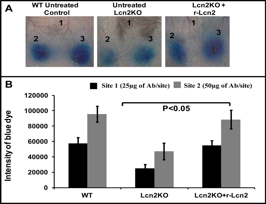 Differential role of lipocalin-2 during immune-complex mediated acute ...