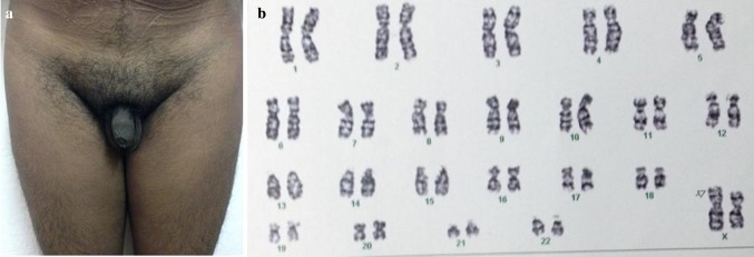 Fig. 2