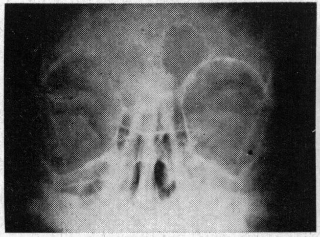 FIGURE 23. (e)