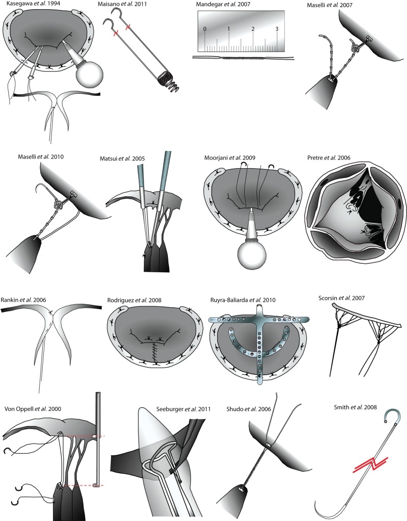 Figure 1B: