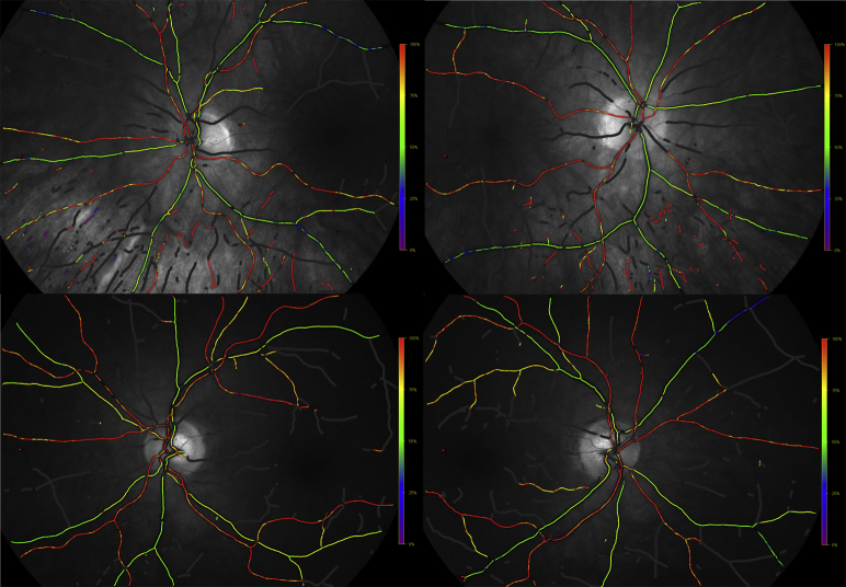 Fig. 1