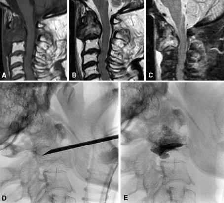 Fig. 3A–E