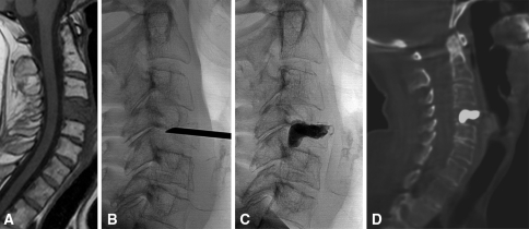 Fig. 4A–D