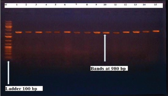 Figure-7