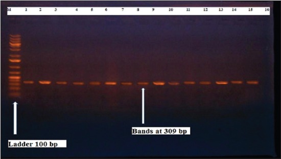 Figure-13