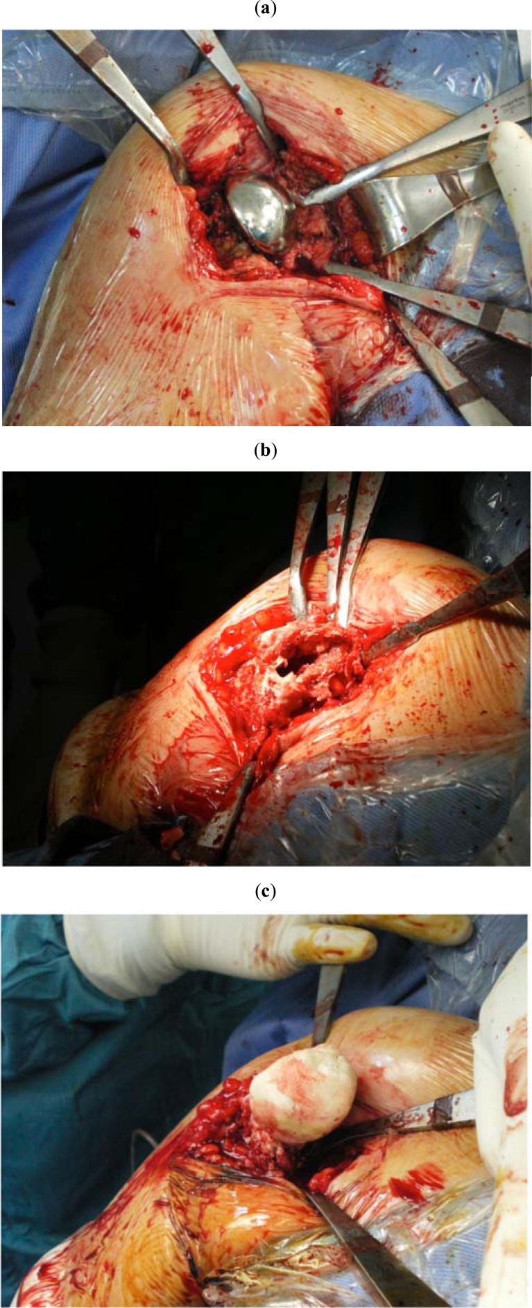 Fig. (5)