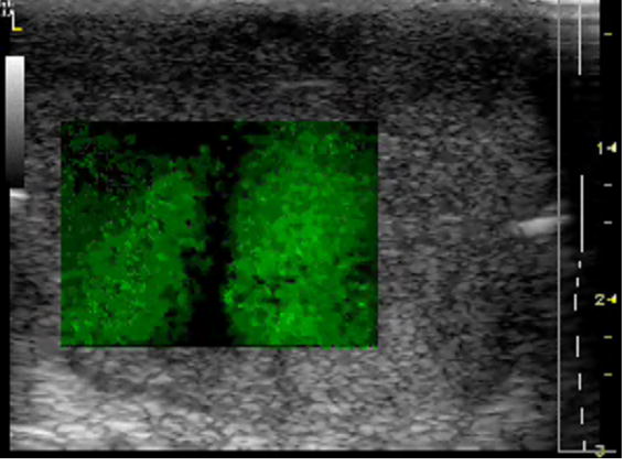 Figure 11