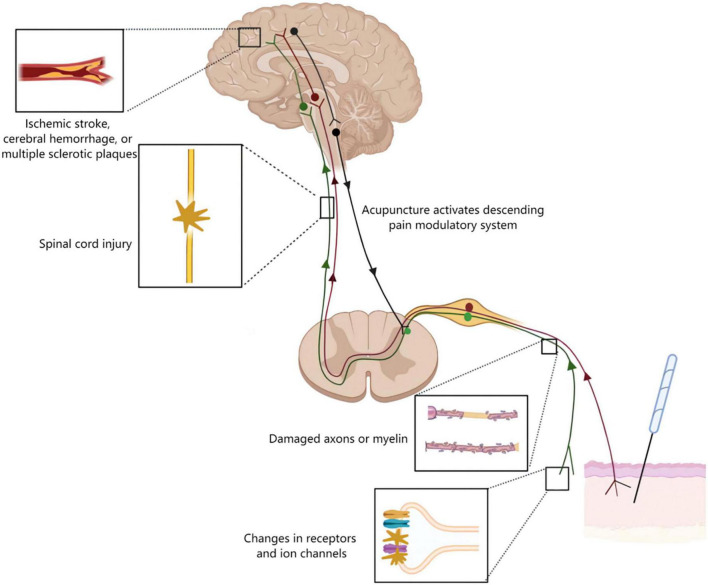 FIGURE 4