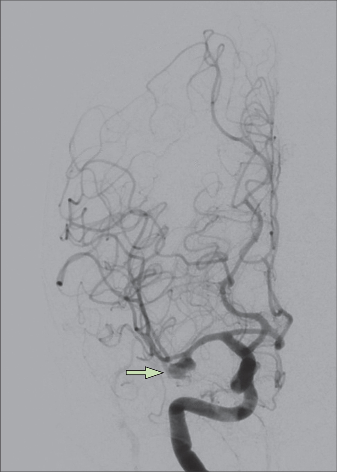 Figure 3: