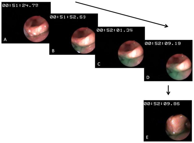 Fig. 4