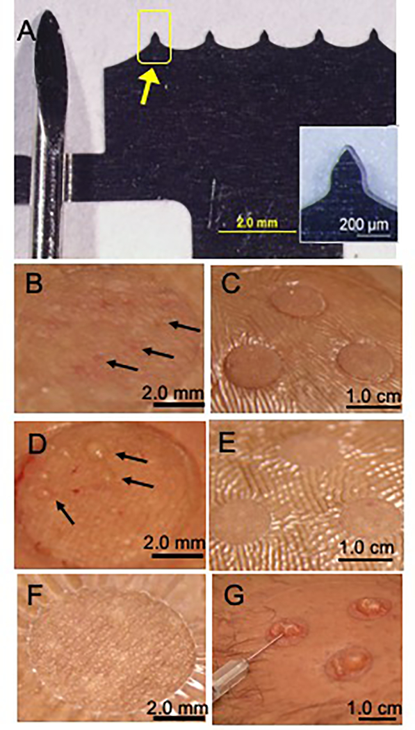 Fig 1.