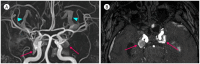 Fig. 9