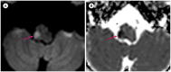 Fig. 17