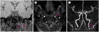 Fig. 22