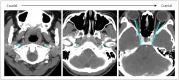 Fig. 21
