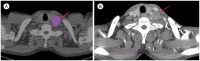 Fig. 19