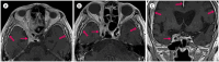 Fig. 11