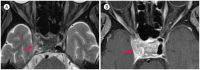 Fig. 13