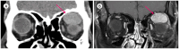 Fig. 12