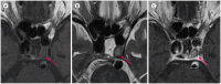 Fig. 10