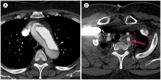 Fig. 20