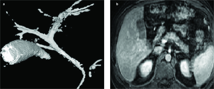 FIG. 3. a–b.