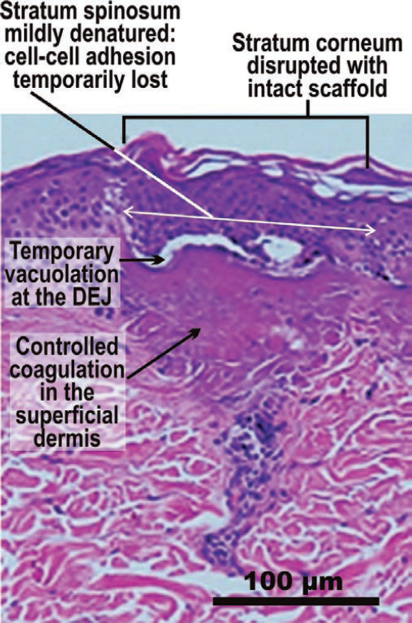 Figure 11: