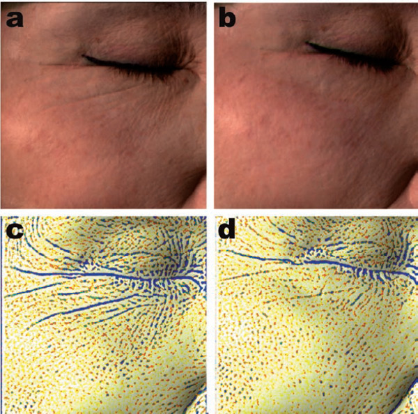 Figure 7: