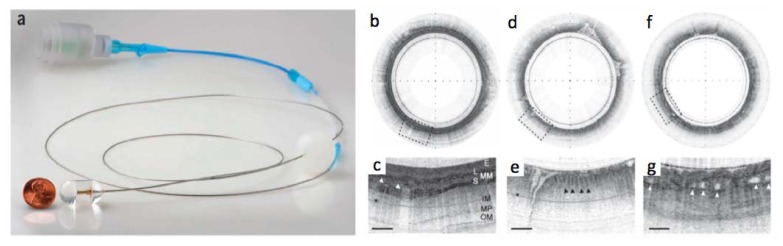 Fig. 16