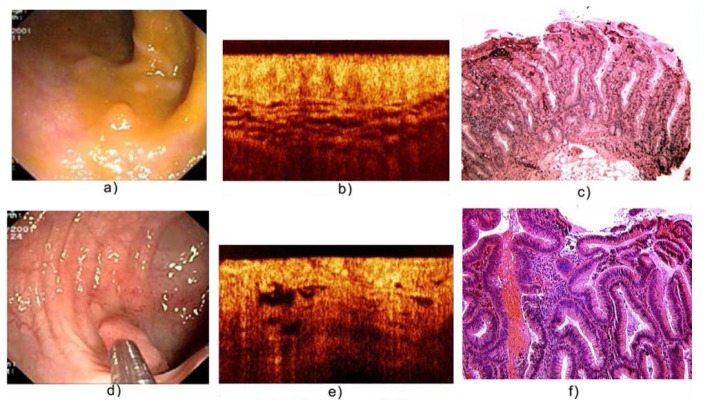 Fig. 18