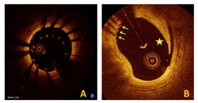 Fig. 10