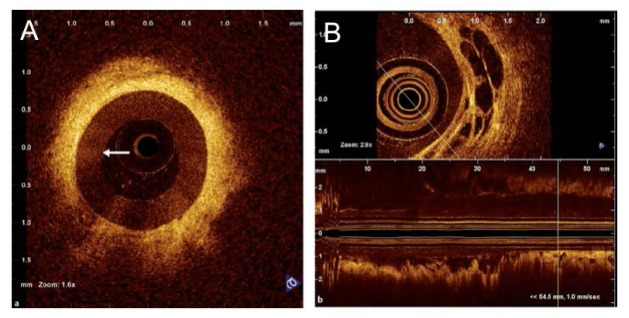 Fig. 19