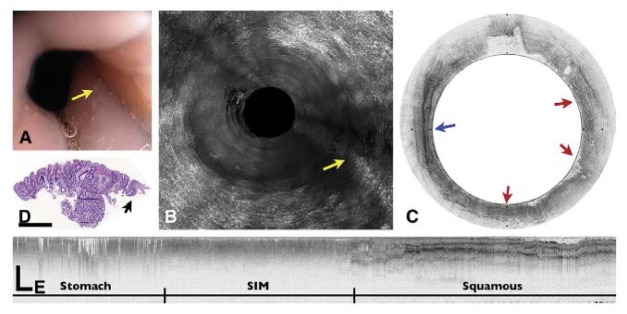 Fig. 12