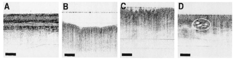 Fig. 11