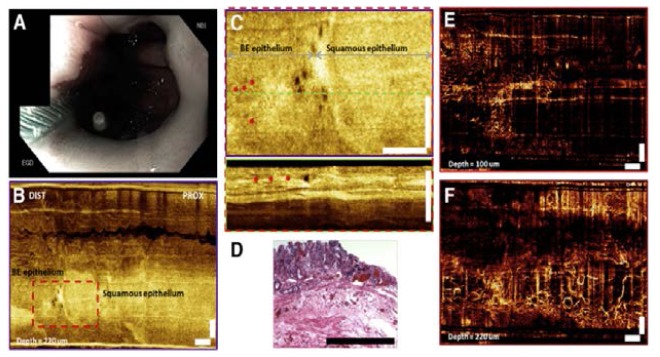 Fig. 15