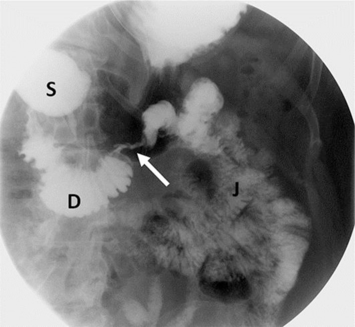 Fig. 2