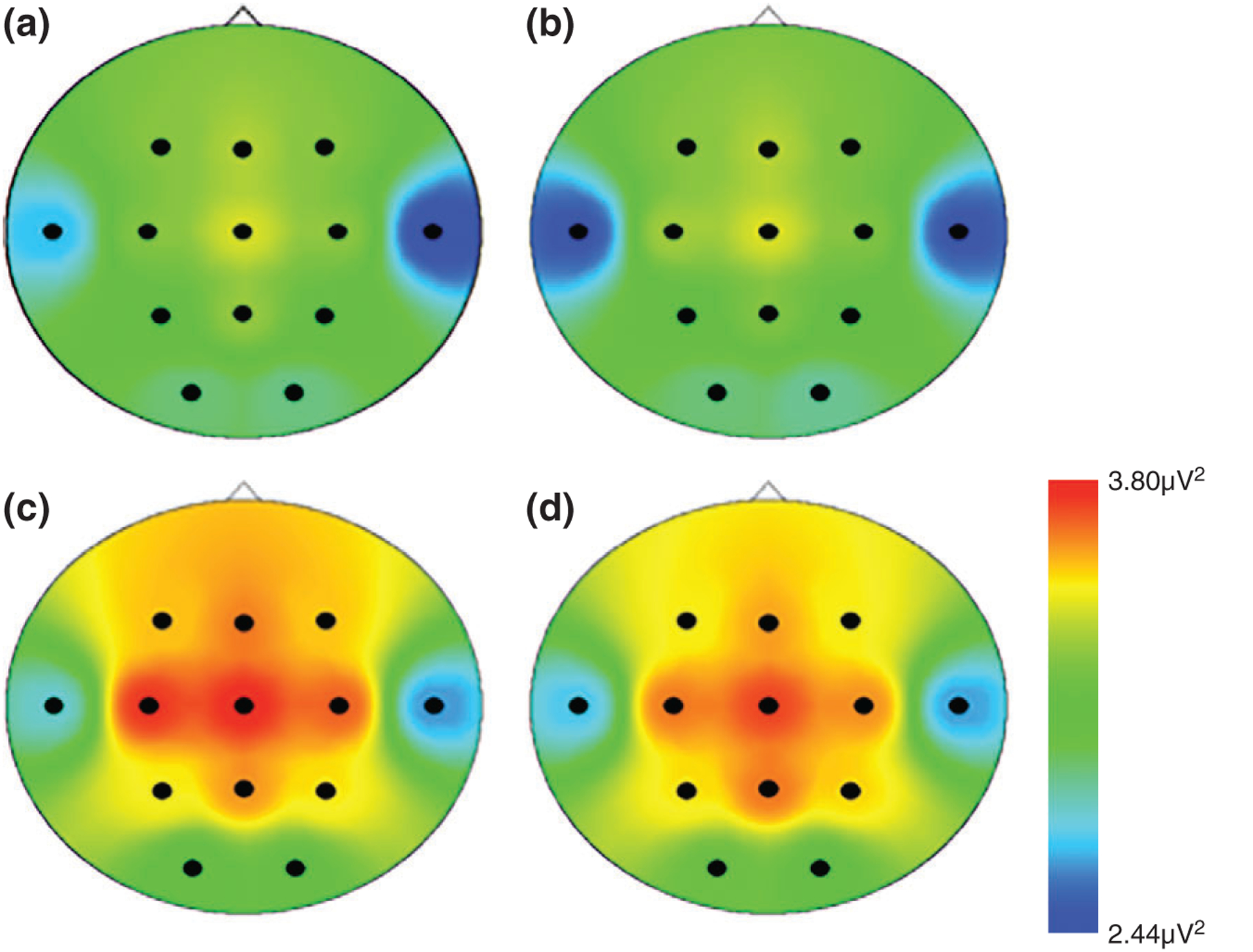 FIGURE 1 |