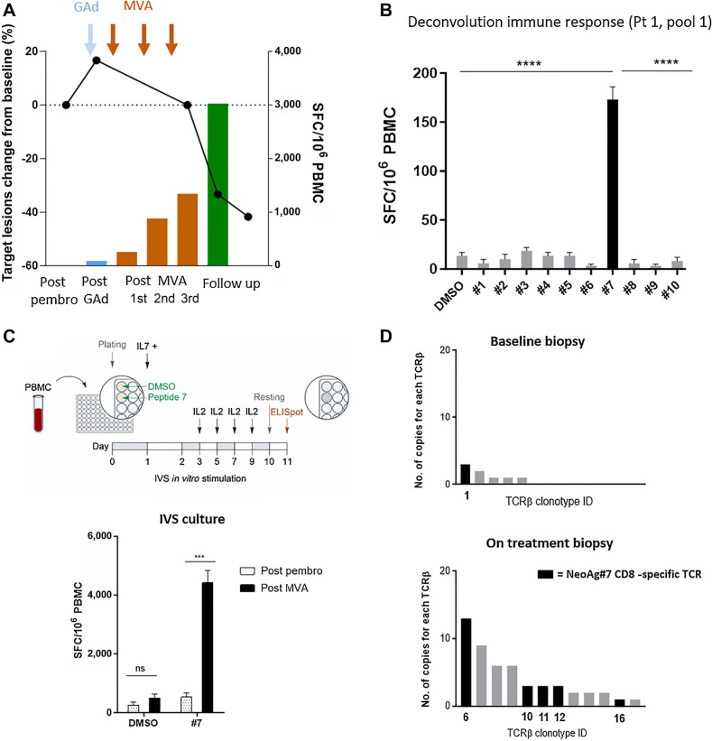 Figure 4. Vaccine-induced neoantigen T cells migrate into the tumor. A, T-cell response assessed by ex vivo ELISpot versus percentage changes in target lesion size (sum of target lesion measurements evaluated per RECIST v1.1.) from baseline are displayed for NOUS-PEV Pt 1. B, Deconvolution of T-cell response by ex vivo ELISpot against individual peptides of the immunogenic pool 1. The immunogenic NeoAg7 is shown in black. The unpaired t test was used to make comparisons (****, P < 0.0001). C, Top, schematic representation of the IVS protocol to expand vaccine induced neoantigen specific T cells against NeoAg7 peptide. Bottom, T-cell responses in Pt 1 measured by IFNγ ELISpot assay after IVS with NeoAg7 peptide. Tested PBMCs were collected after pembrolizumab (week 10) and after vaccination (week 14). The unpaired t test was used to make comparisons (***, P < 0.001). D, Expansion and diversification of TCRβ repertoire in pre- and posttreatment tumor biopsies of Pt 1. Each bar is a TCRβ individual clone; the clonotypes specific for NeoAg7 detected on the tumor biopsies of Pt 1 are shown as black bars.