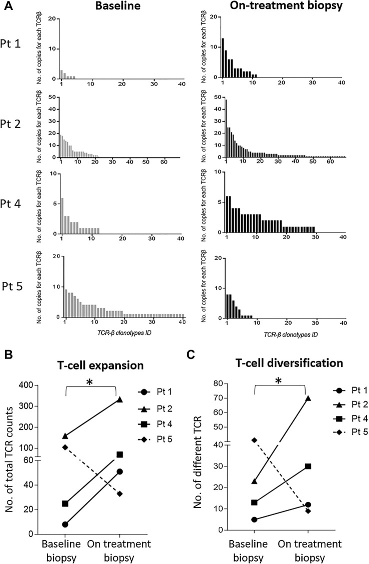 Figure 3. Increase of intratumoral T cells post-NOUS-PEV treatment with vaccine-induced T cells infiltrating tumor. A, Expansion and diversification of TCRβ repertoire in pre- and posttreatment tumor biopsies in four NOUS-PEV patients (3 PR;1 SD). Each bar indicates the abundance of individual TCRβ clones detected in the total tumor RNAs extracted from the biopsies collected at the two time points (details in Patients and Methods). B, Total number of TCRβ counts detected in tumor biopsies estimated by summing up the abundance of the individual clones reported in A. The solid lines represent NOUS-PEV patients receiving the full vaccine regimen GAd/MVA; the dashed line represents the patient (Pt 5) who only received MVA-PEV. C, Number of individual clones with different TCRβ CDR3 detected in the patients’ tumor biopsies (*, P ≤ 0.05, paired t test).