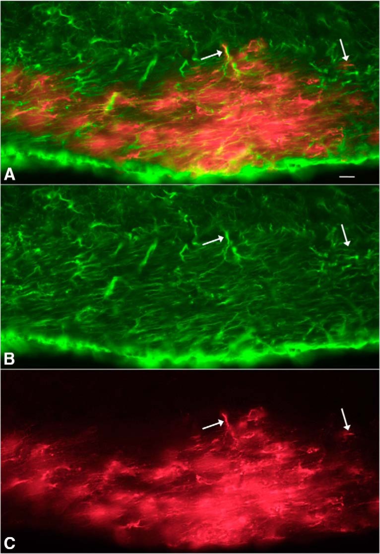 Figure 11.