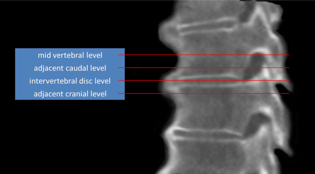 Fig. 2