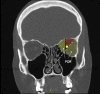 Fig. 5