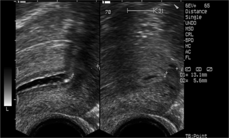 Fig. 1